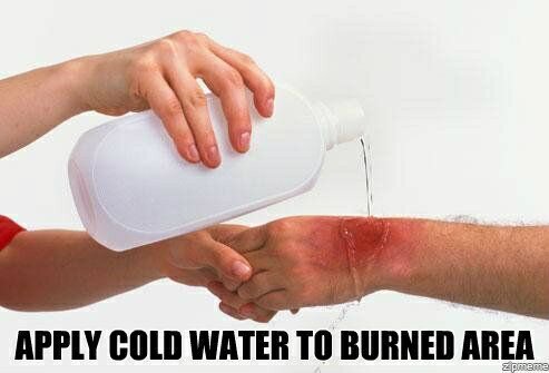 apply_cold_water_to_the_burned_area-145373_zps015d8a32.jpg